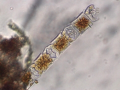 Odontella aurita