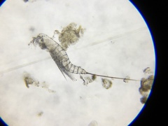 Microsetella