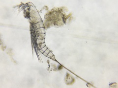 Microsetella