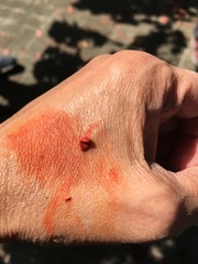 Artocarpus tonkinensis