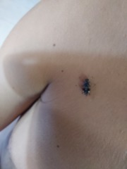 Cyphomyia wiedemanni