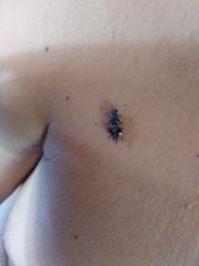 Cyphomyia wiedemanni