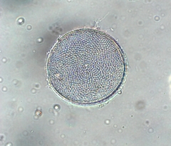 Coscinodiscophycidae