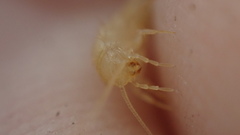 Coletinia