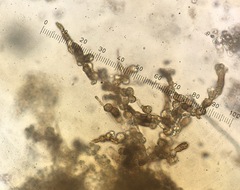 Pseudosydowia eucalypti