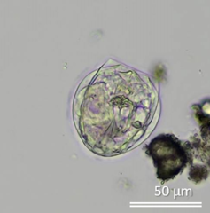 Lecane closterocerca