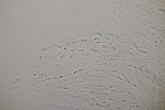 Ruzenia spermoides