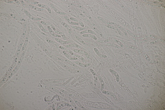 Ruzenia spermoides
