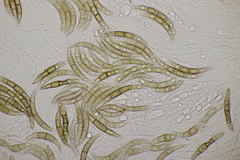 Melogramma campylosporum