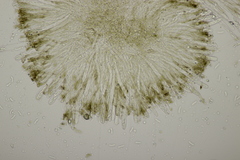 Sclerencoelia fraxinicola