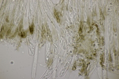 Sclerencoelia fraxinicola