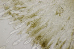 Sclerencoelia fraxinicola