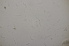 Sclerencoelia fraxinicola