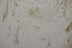 Sclerencoelia fraxinicola