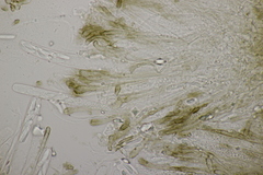 Sclerencoelia fraxinicola