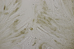 Sclerencoelia fraxinicola