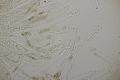 Sclerencoelia fraxinicola