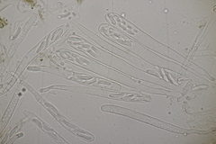 Sclerencoelia fraxinicola