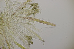 Sclerencoelia fraxinicola