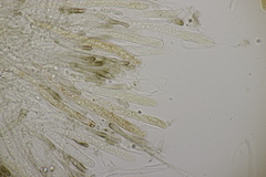 Sclerencoelia fraxinicola