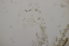 Trichoderma pulvinatum