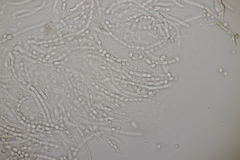 Trichoderma pulvinatum