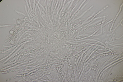 Trichoderma pulvinatum