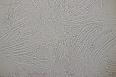 Trichoderma pulvinatum