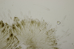Sclerencoelia fraxinicola