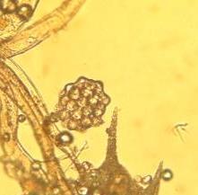 Coelastrum microporum
