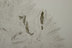 Chaetosphaerella phaeostroma