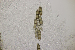 Chaetosphaerella phaeostroma