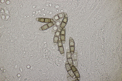Chaetosphaerella phaeostroma