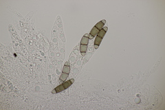 Chaetosphaerella phaeostroma