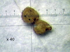 Spergularia bocconei