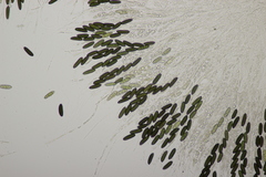 Rosellinia britannica