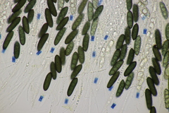Rosellinia britannica