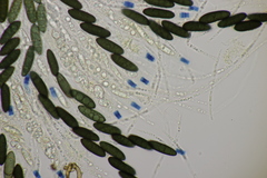 Rosellinia britannica