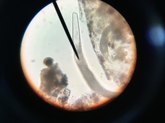 Spirostomum