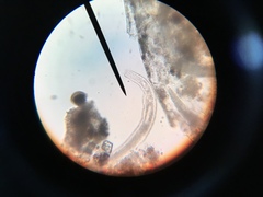 Spirostomum