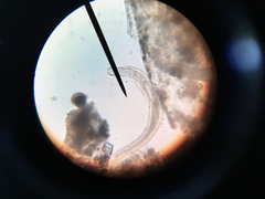 Spirostomum