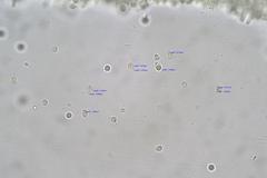 Multifurca stenophylla
