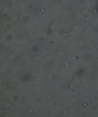 Byssomerulius psittacinus