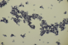 Gloeocystidiellum porosum