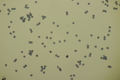 Gloeocystidiellum porosum