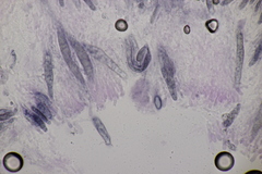Gloeocystidiellum porosum