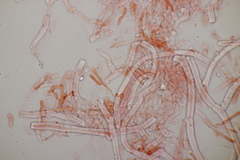 Phanerochaete sordida