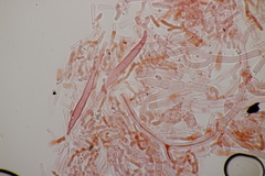 Phanerochaete sordida