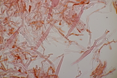 Phanerochaete sordida