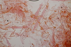 Phanerochaete sordida